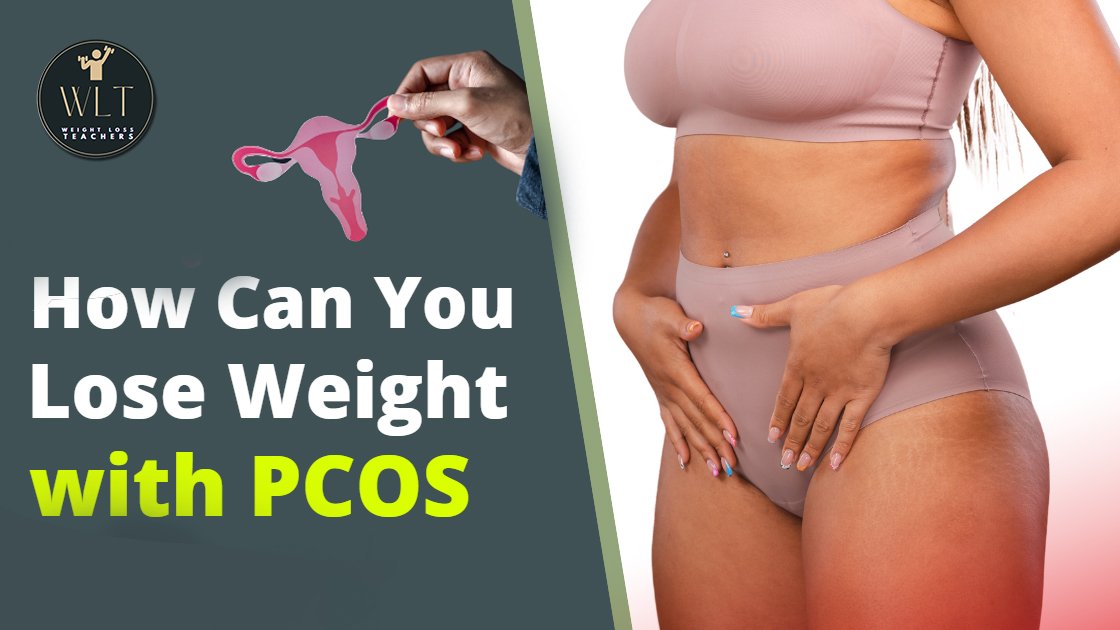 PCOS