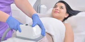 CoolSculpting
