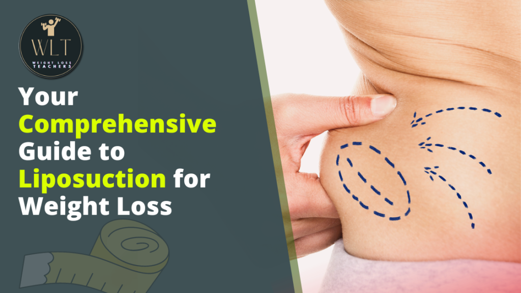 Your-Comprehensive-Guide-to-Liposuction-for-Weight-Loss