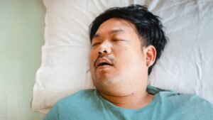 sleep-apnea